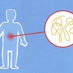 Mögliche Anzeichen und Symptome von Magen-Darm-Grippe